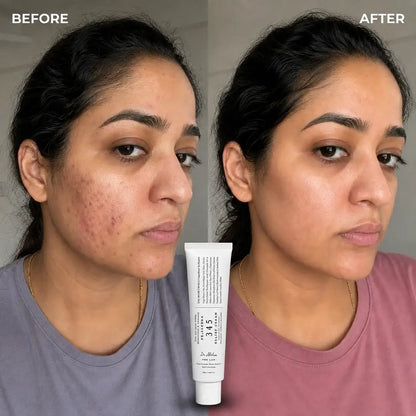 The Viral Dr. Althea 345 Relief Cream