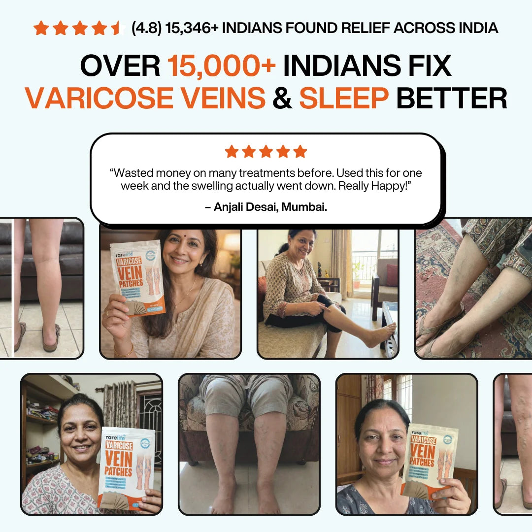 The Original Varicose Vein Relief Patches by RareLife